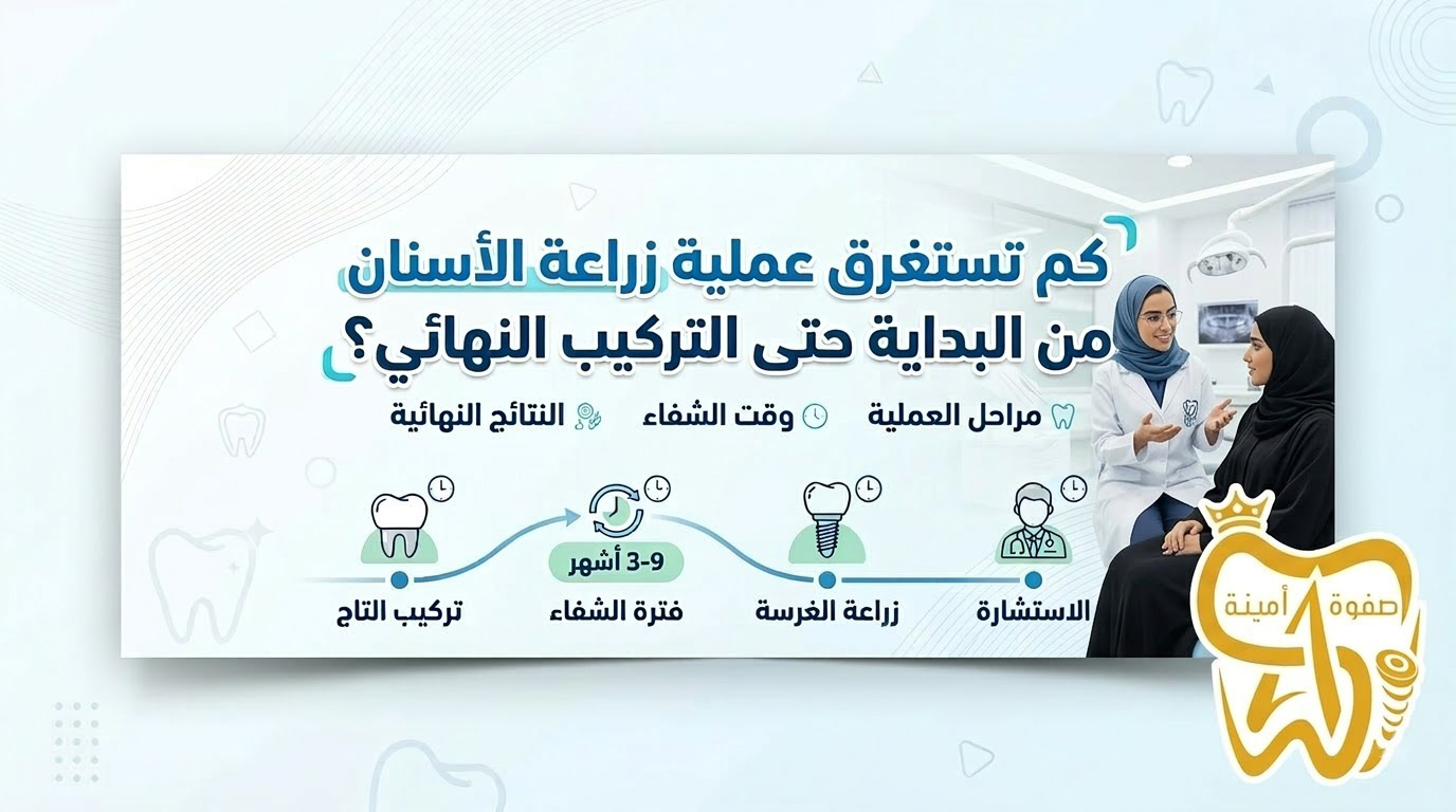 كم تستغرق عملية زراعة الأسنان من البداية حتى التركيب النهائي؟