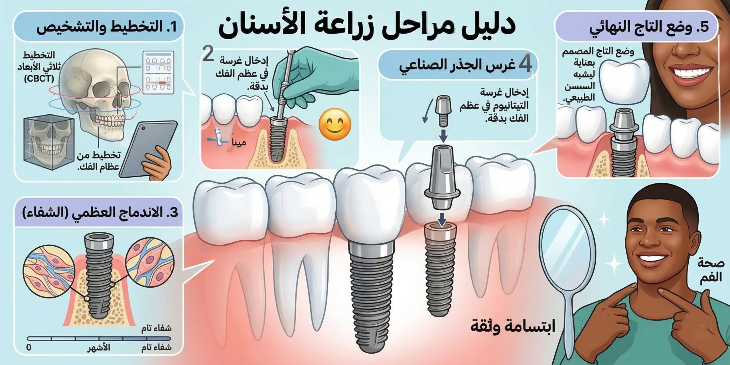 كيف تتم زراعة الأسنان في بريدة