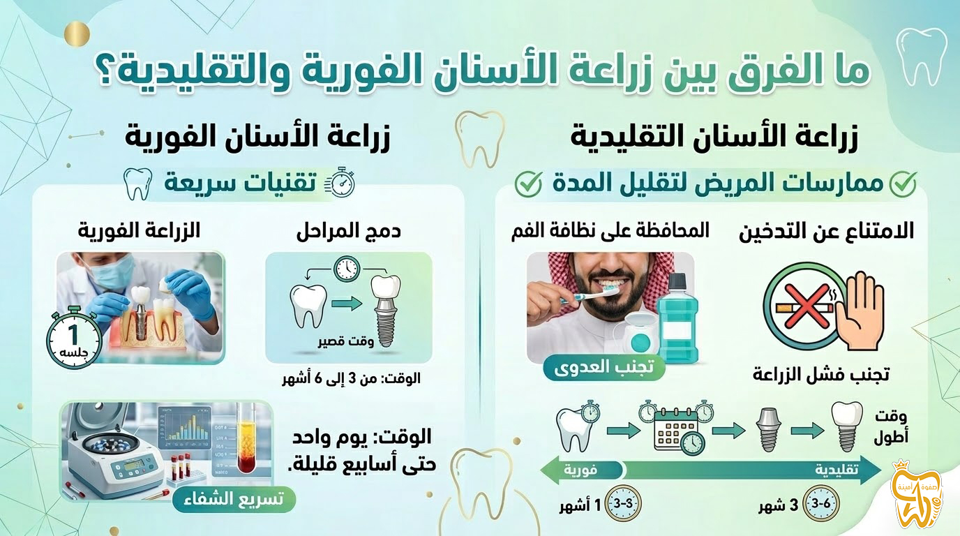 ما الفرق بين زراعة الأسنان الفورية والتقليدية؟ ما الفرق بين زراعة الأسنان الفورية والتقليدية؟