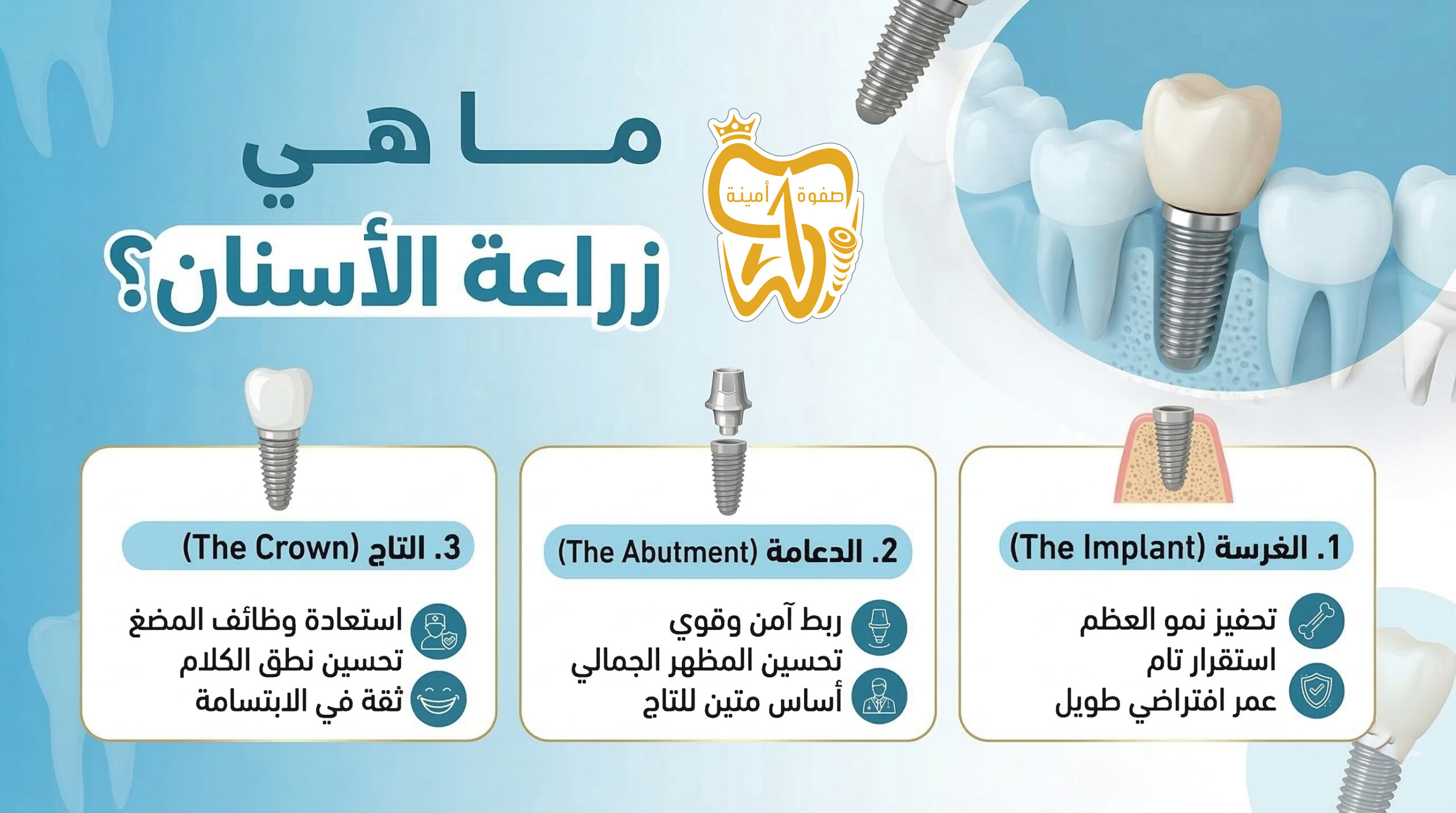 ما هي زراعة الأسنان